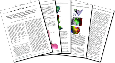 article