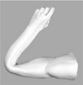 pictures/collapsing_elbow.png
